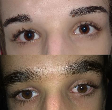 eyebrow growth before and after.